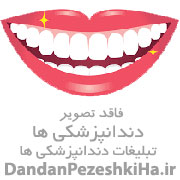 دندانپزشکی زیبادنت
