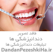 خدمات دندانپزشکی کامپوزیت دندان لمینت بلیچینگ